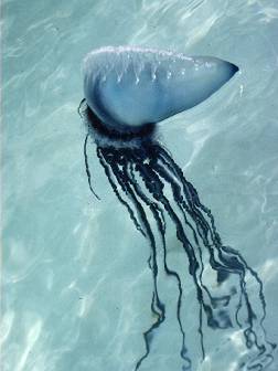 Explore stories of serious stings from Portuguese Man-of-War